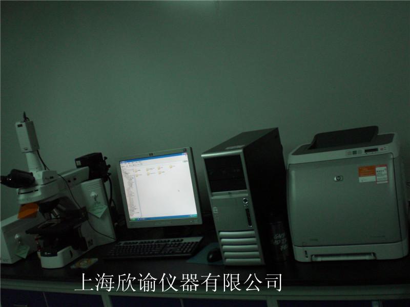 [欄目置頂]染色體分析系統(tǒng)（XY-RS-A2）、高配核型分析系統(tǒng)